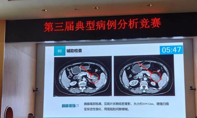 《中心医院3游戏攻略大揭秘》（全面指南助你一战成名）